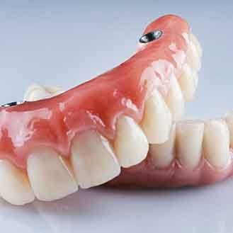 Implant dentures are a combination of dental implants and traditional dentures